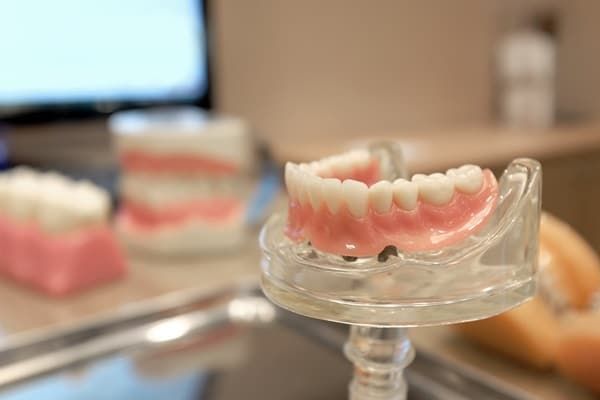 are-dentures-implants-removable-big-2