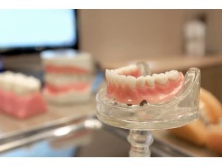are-dentures-implants-removable-small-2