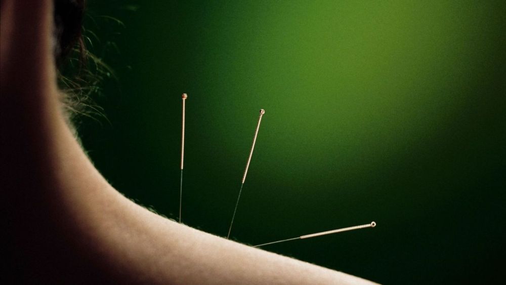modern-wellness-through-electro-acupuncture-treatment-big-0
