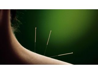 modern-wellness-through-electro-acupuncture-treatment-small-0