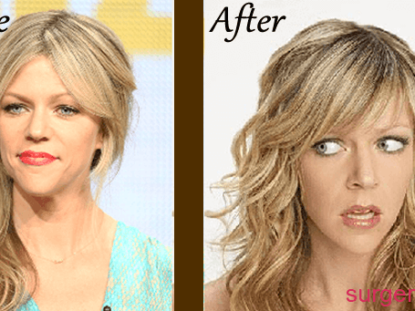 technical-insight-into-celebrity-cosmetic-trends