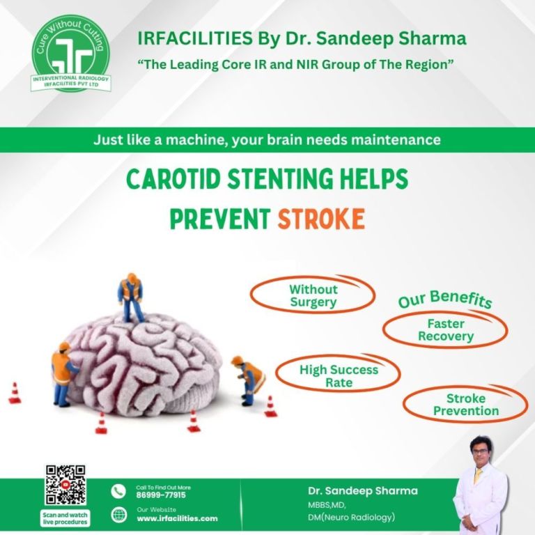 why-choose-carotid-artery-stenting-in-india-big-0