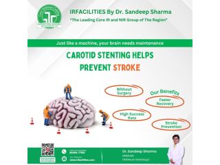 why-choose-carotid-artery-stenting-in-india-small-0