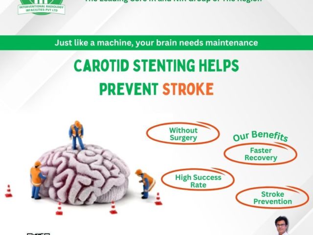 why-choose-carotid-artery-stenting-in-india