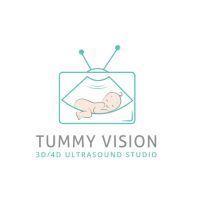 tummy-vision-3d4d-ultrasound-gender-reveal-big-0