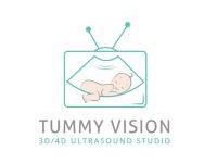 tummy-vision-3d4d-ultrasound-gender-reveal