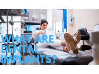 how-long-do-cosmetic-dental-treatments-last-in-texas-small-0