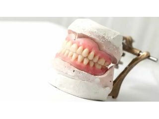 comfortable-durable-houston-dentures-small-0