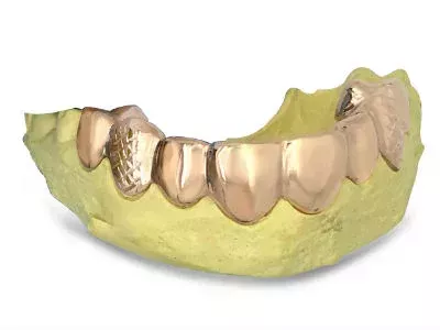 custom-grillz-in-las-vegas-zaragoza-jewelry-designs