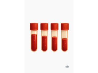 order-allergy-test-kits-online-for-accurate-results-be-so-well-small-0