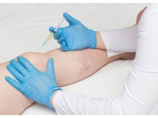 knee-pain-doctor-in-fidi-manhattan-nyc-small-0