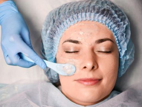 glycolic-acid-removal