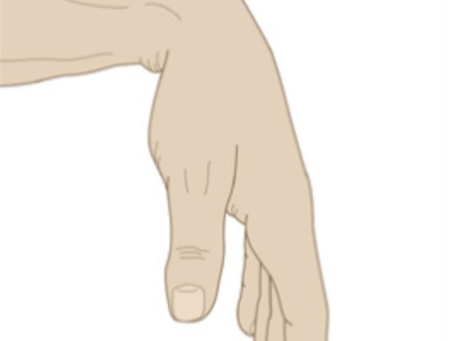 nerve-conduction-study-los-angeles