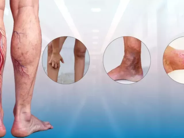 expert-vein-specialist-doctor-for-advanced-vein-treatment