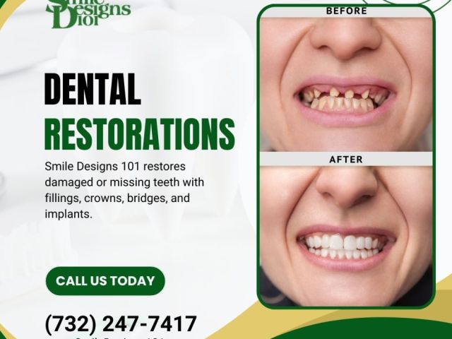 restore-your-smile-today-with-expert-dental-restoration-near-you