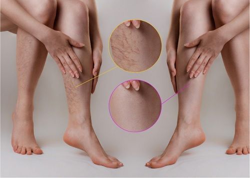 tips-for-finding-the-best-long-island-vein-experts-in-your-area-big-0
