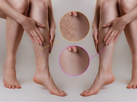 tips-for-finding-the-best-long-island-vein-experts-in-your-area