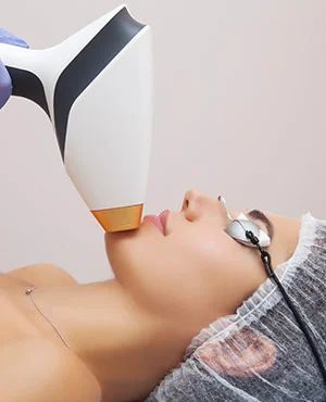 lumecca-photofacial-in-midland-tx-smooth-flawless-skin-big-0