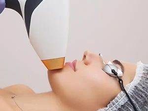 lumecca-photofacial-in-midland-tx-smooth-flawless-skin