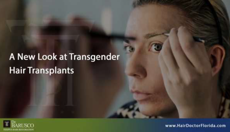 transgender-hair-transplants-in-florida-big-0