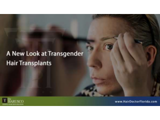 transgender-hair-transplants-in-florida-small-0