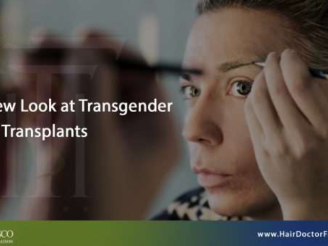 transgender-hair-transplants-in-florida
