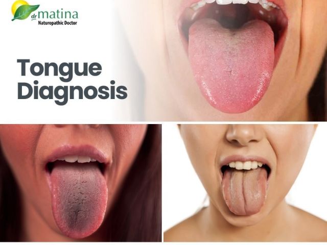 tongue-diagnosis-for-holistic-health-insights-drmatina