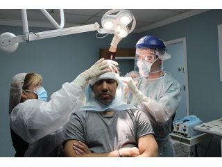 hair-restoration-services-in-miami-boost-your-confidence-small-0