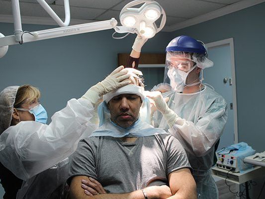 hair-restoration-services-in-miami-boost-your-confidence