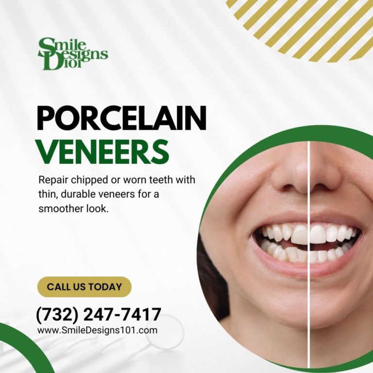 transform-your-smile-with-porcelain-veneers-book-today-big-0