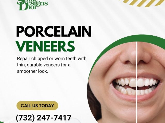 transform-your-smile-with-porcelain-veneers-book-today
