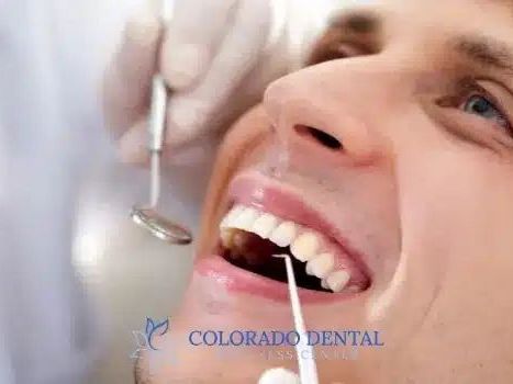 what-to-expect-during-deep-cleaning-for-healthier-gums