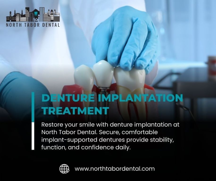 benefits-of-denture-implantation-for-active-lifestyles-big-0