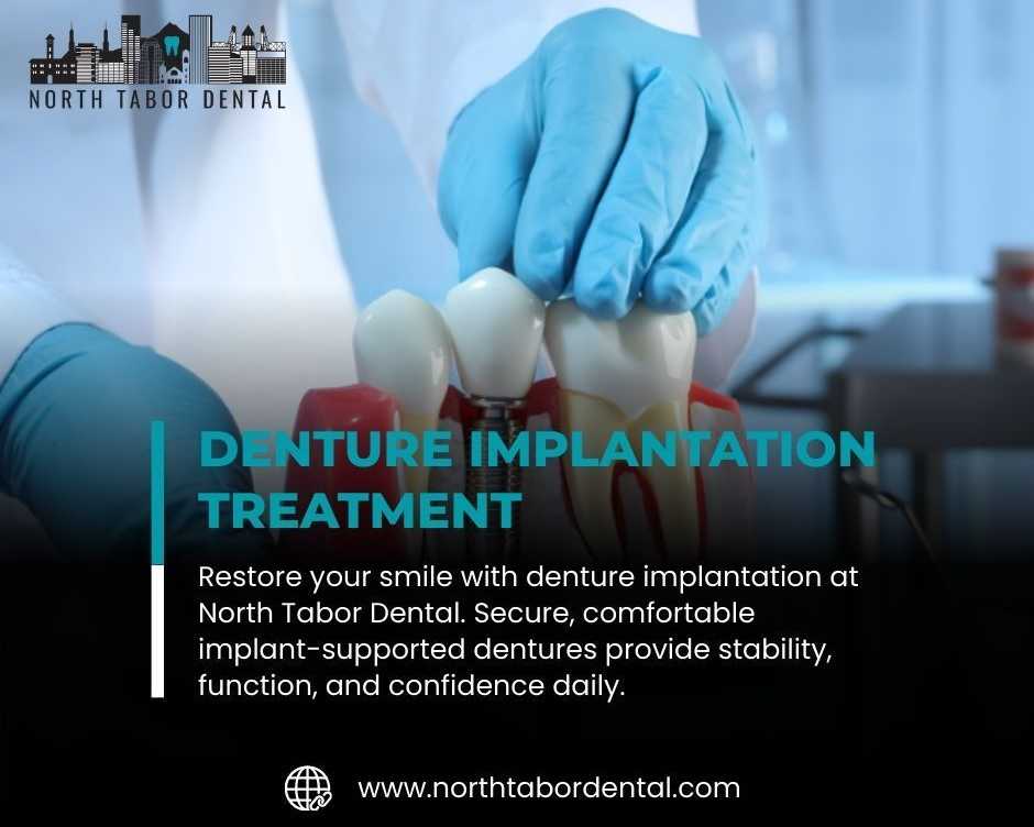 benefits-of-denture-implantation-for-active-lifestyles