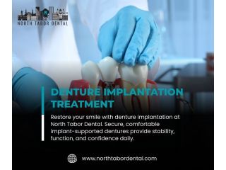 benefits-of-denture-implantation-for-active-lifestyles-small-0