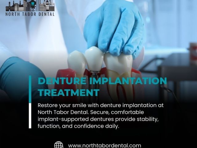 benefits-of-denture-implantation-for-active-lifestyles