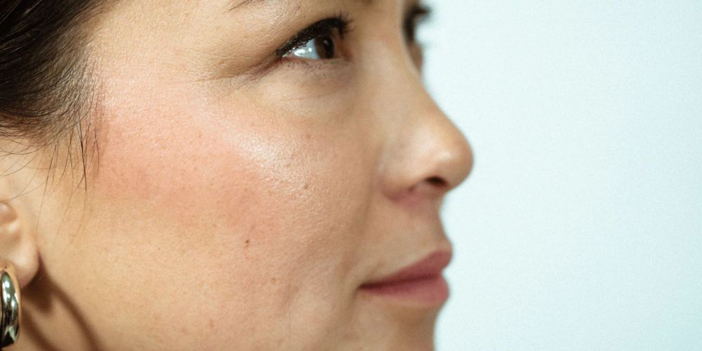 asian-glow-patch-a-simple-way-to-reduce-alcohol-flush-big-0