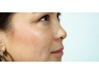 asian-glow-patch-a-simple-way-to-reduce-alcohol-flush-small-0
