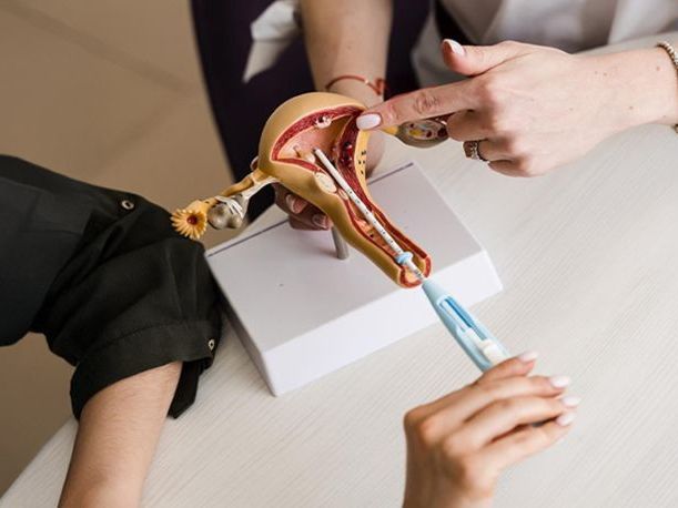 iui-treatment-service-bakersfield-california-acacio-fertility
