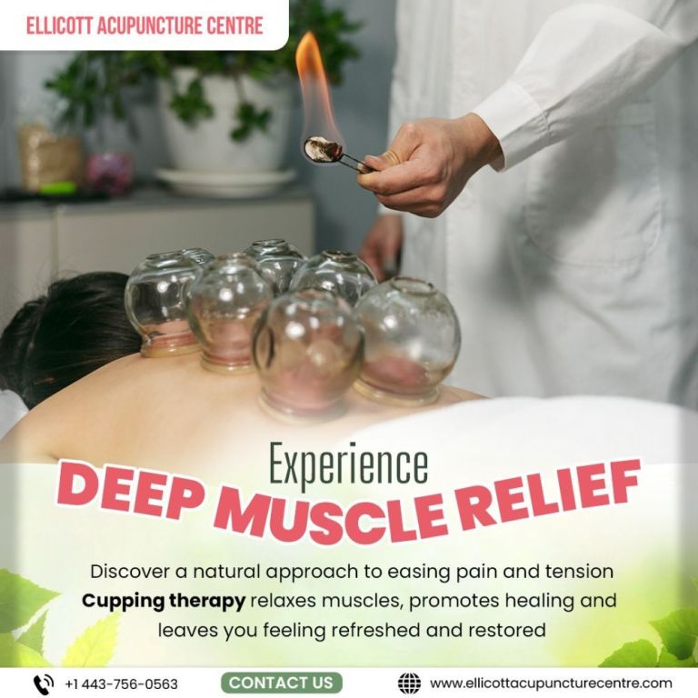 professional-acupuncture-chinese-medicine-services-big-0