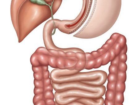 gastric-sleeve-surgery-treatment-in-tuscaloosa-alabama