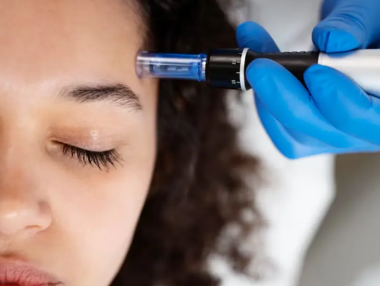 best-lip-filler-in-covina-ca