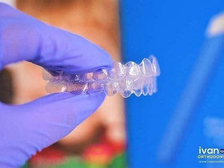 is-there-an-affordable-and-reliable-orthodontist-near-me