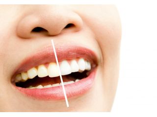 expert-orthodontist-lake-oswego-for-perfect-smiles-small-0