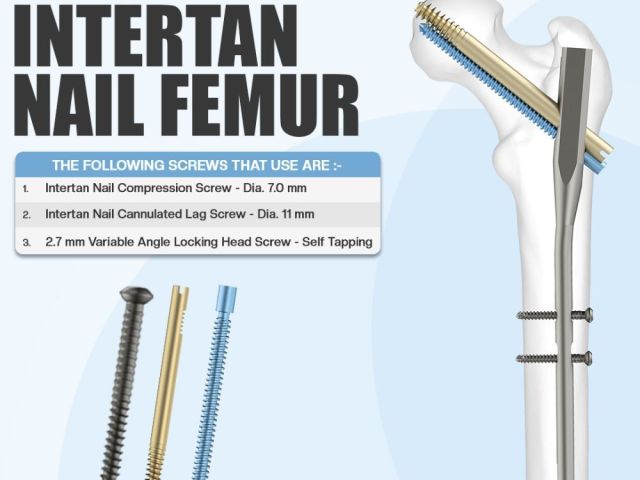 reliable-fixation-with-intertan-nail-femur-by-siora-surgicals