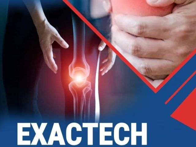 exactech-hip-lawsuit-in-winter-park-people-for-law