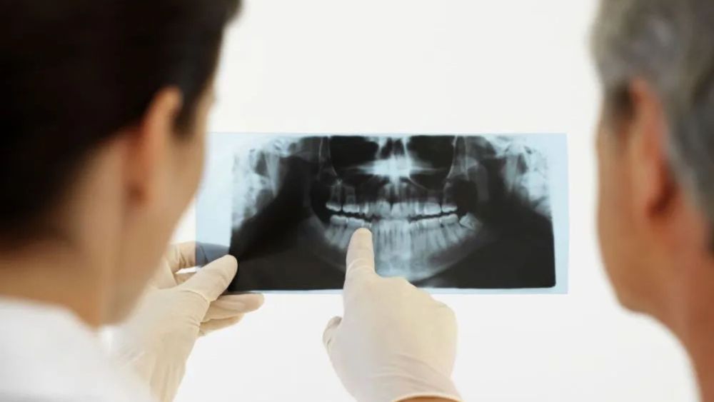 anchorage-periodontal-treatment-big-0
