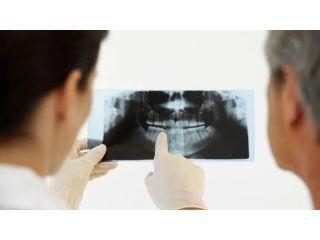 anchorage-periodontal-treatment-small-0