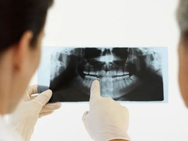 anchorage-periodontal-treatment