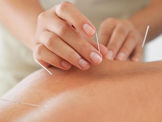 avoid-surgery-holistic-pain-treatment-in-hollywood-fl